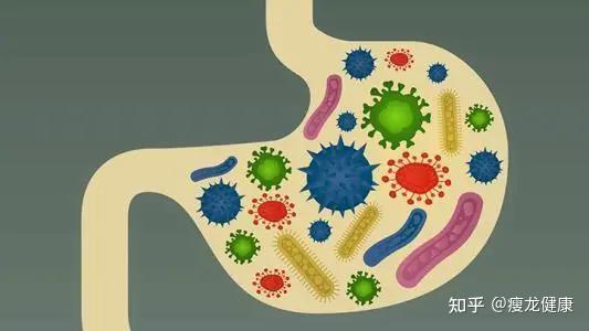 克雷伯菌:強直as和克羅恩的主因