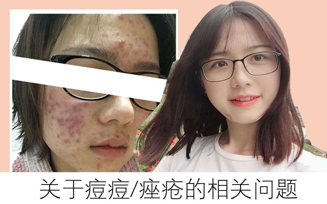 v2-99bbeee00ca3e4354b206de493ed47b5_1440w.jpg?source=172ae18b