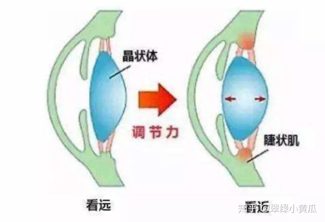 散瞳验光！你应该知道的那些事 - 知乎