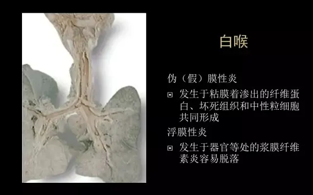 病理学大体标本库 - 知乎