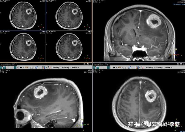 磁共振增强扫描如何量化对比剂效果 - 知乎