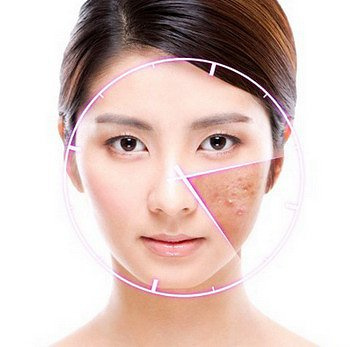 最好的祛痘产品排行榜适合中学生的祛痘产品推荐 知乎