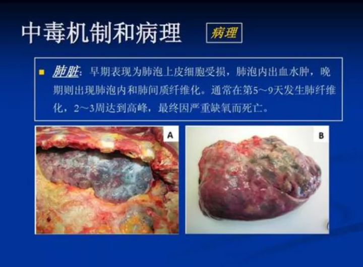逼婚失败后 女博士喝下百草枯 有多少人还在拿无知玩命 知乎 逼婚失败后 女博士喝下百草枯 有多少人还在拿无知玩命 知乎