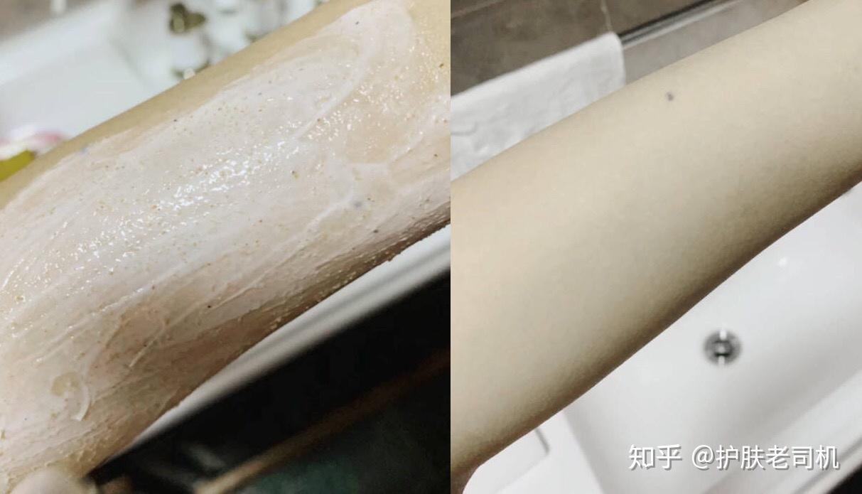 去鸡皮肤用什么好知乎(去鸡皮肤用什么好知乎女生) 去鸡皮肤用什么好知乎(去鸡皮肤用什么好知乎女生)