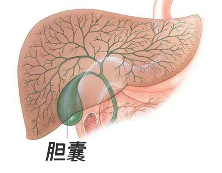 胆囊息肉位置示意图图片