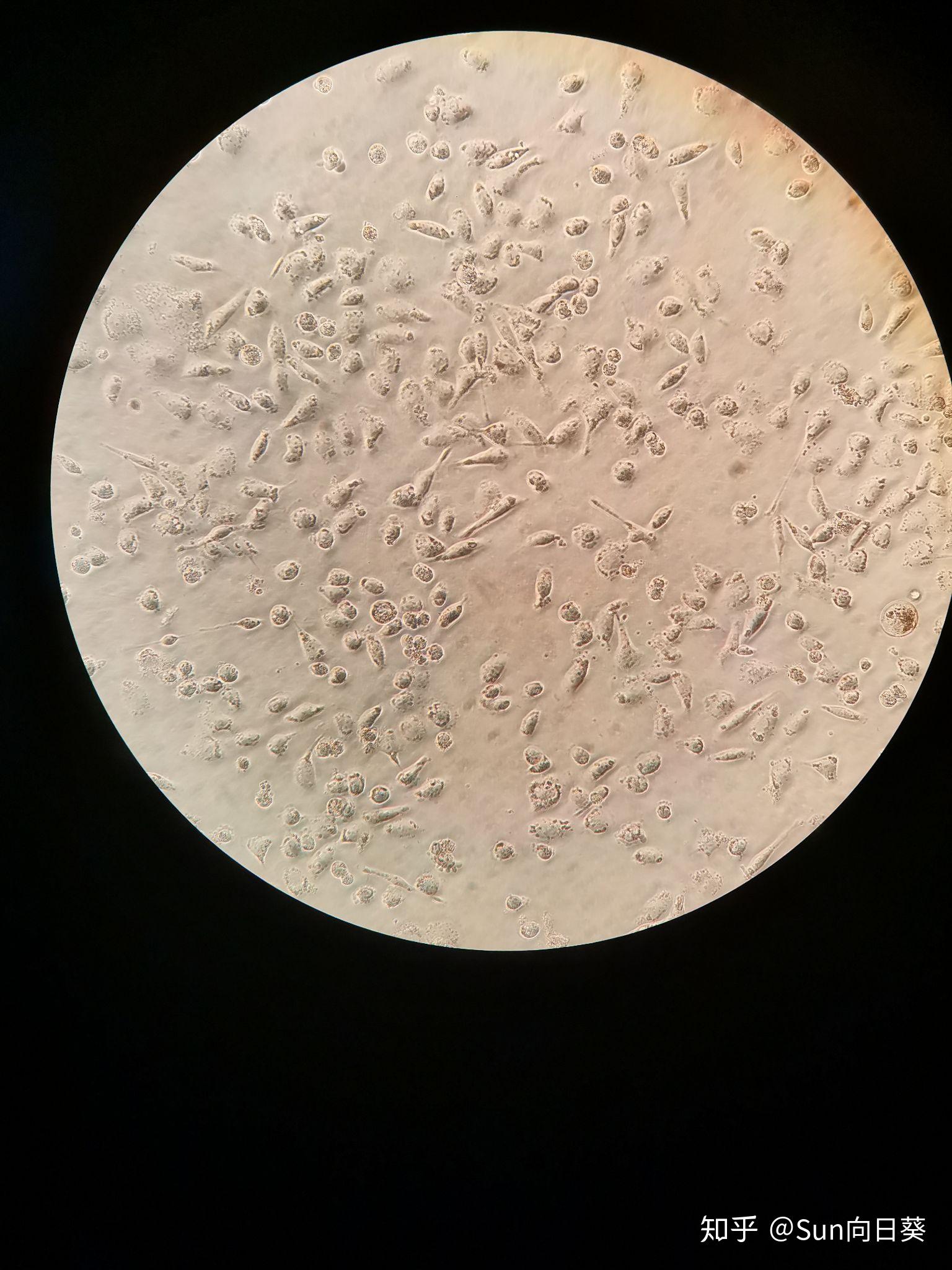诺基亚5230拍摄的显微镜下正常红细胞和白细胞 - Powered by Discuz!