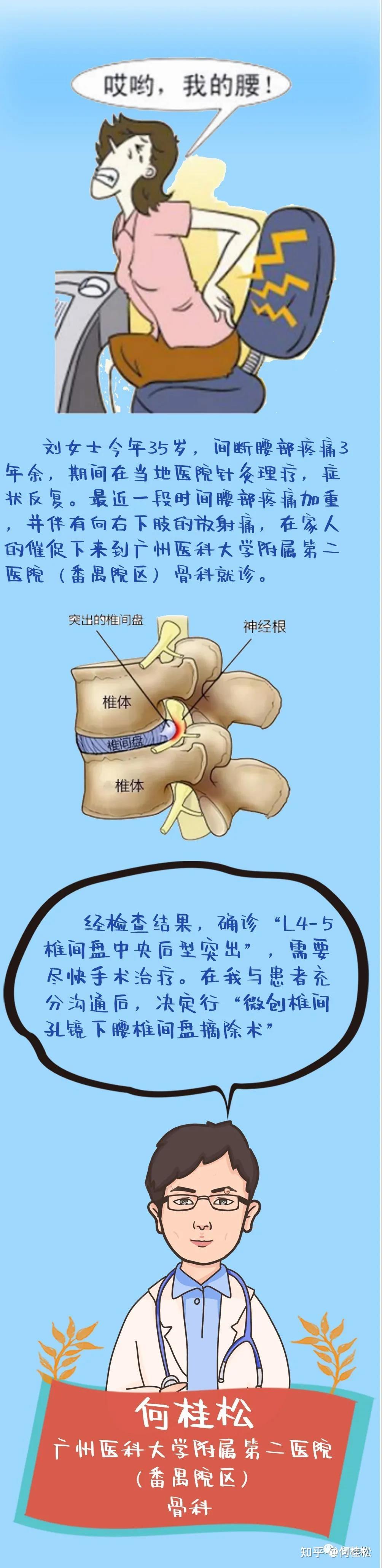 腰椎骨质增生怎么治疗图片