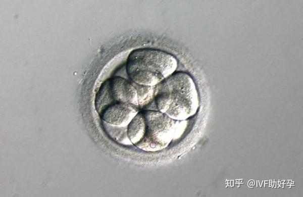 胚胎培养和移植哪个环节最重要