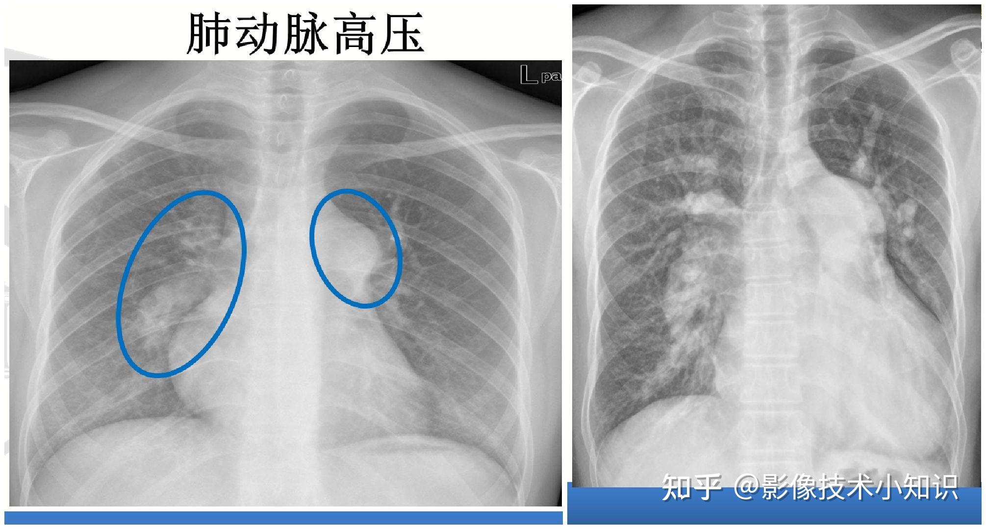 心脏的影像知识（2） - 知乎