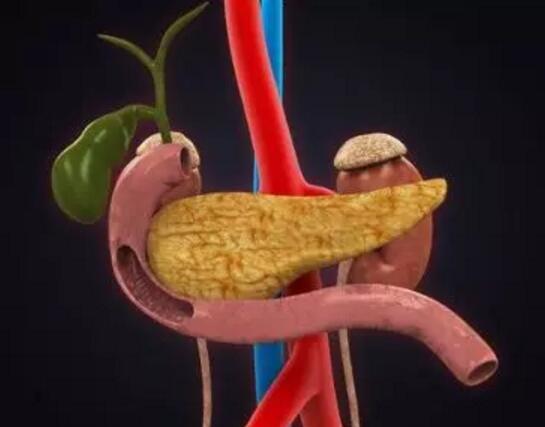 什么是胰腺癌?