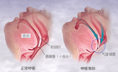 v2-9ae61c79520fe17664ab35eb52f40922_1440w.jpg?source=172ae18b