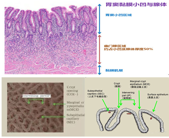 胃小凹结构图图片