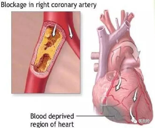 v2-9b3d7614006ad904aa0476e2b105fcb6_1440w.jpg?source=172ae18b