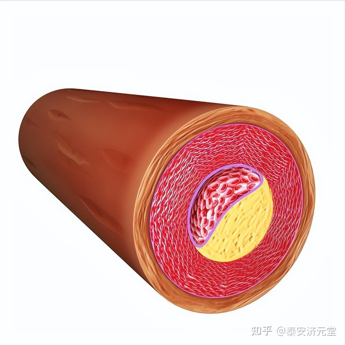 三七粉对消除动脉斑块有作用吗?这3条你要知道 - 知乎