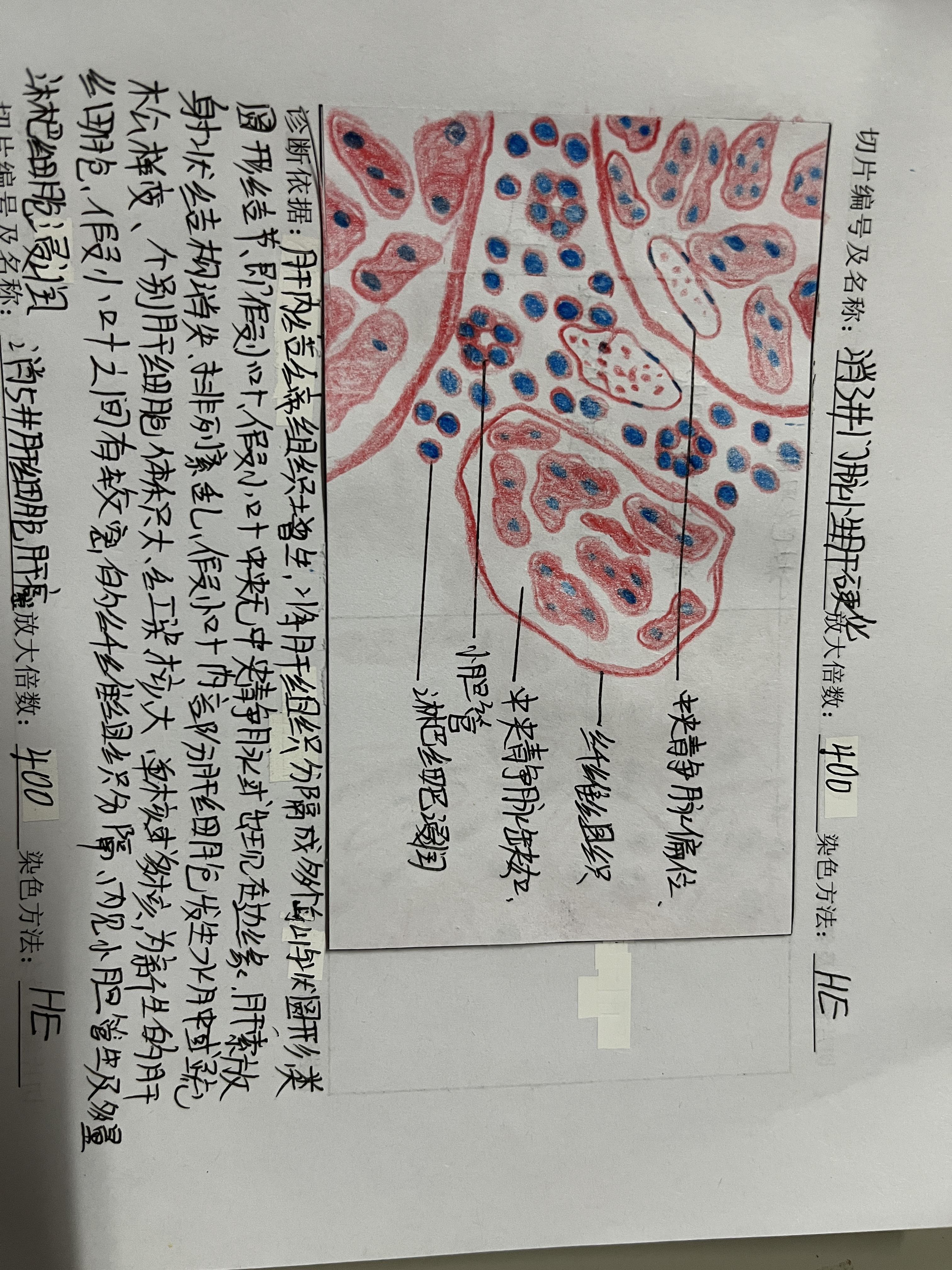 肝细胞图片手绘图片