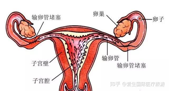 v2-9b5eae91756d8087ebb4604e7bd474f1_r.jpg