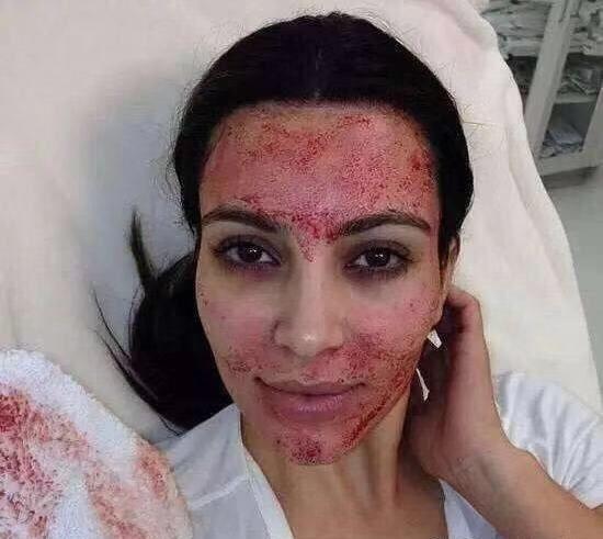 护肤实录:刷酸,逆天改命