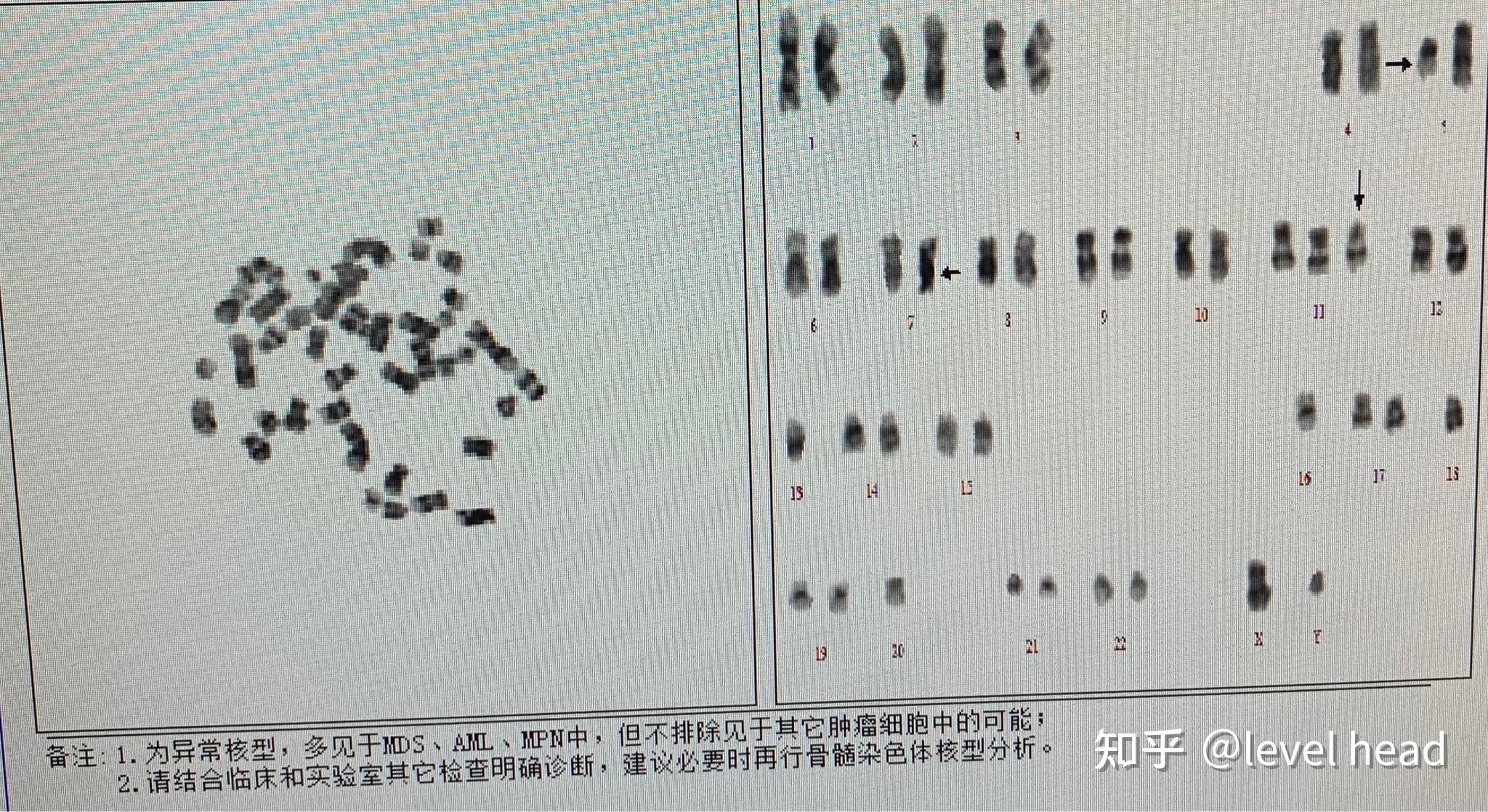 mds在遗传学中的浮现fish