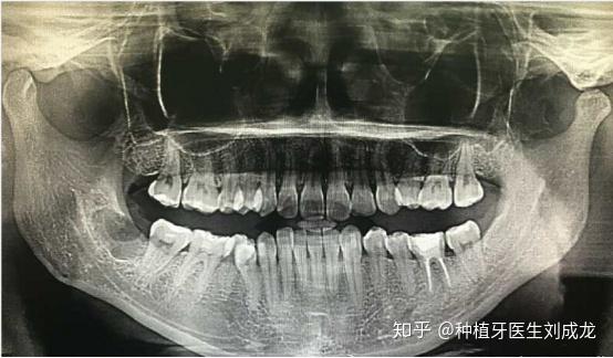 智齿之旅，一部拔智齿短剧的背后故事