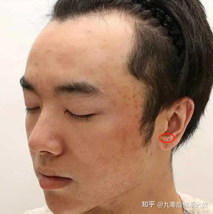 华晨宇被网友爆料整容晒出植发照网友吐槽太丑意外撞脸王祖蓝