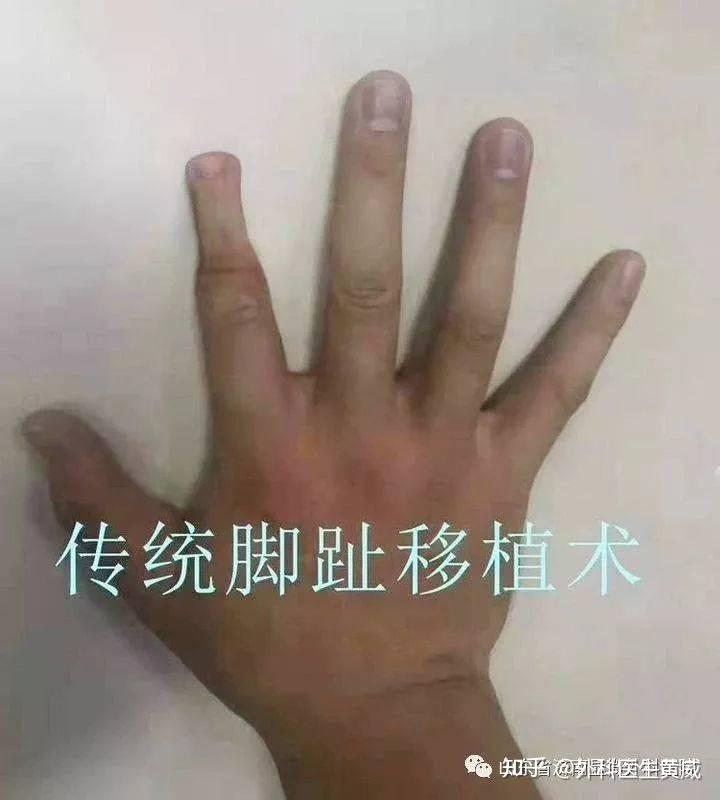 v2-9bbf38c7d5d487ab29c9e8eb90ec9f99_r.jpg