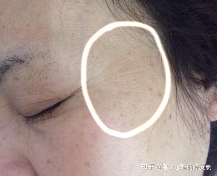 从细纹到皱纹聊聊皮肤管理的重要性