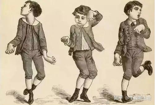 致命的舞蹈罕见病之亨廷顿舞蹈症基因检测