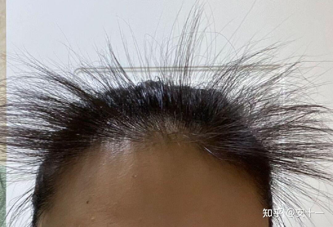 碎发太多怎么办?每天早上都要好长时间打理! - 知乎