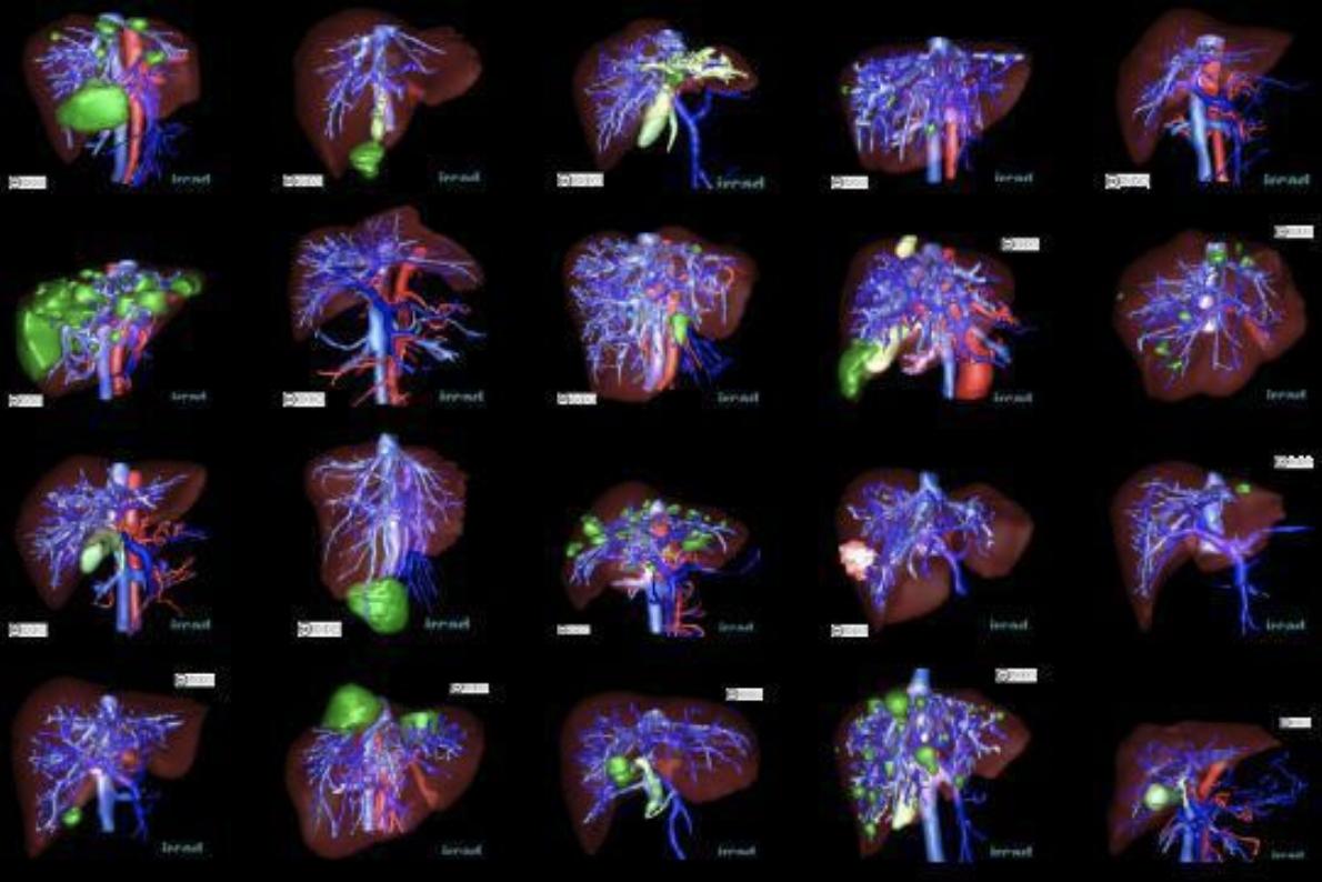 医学图像开源数据集汇总