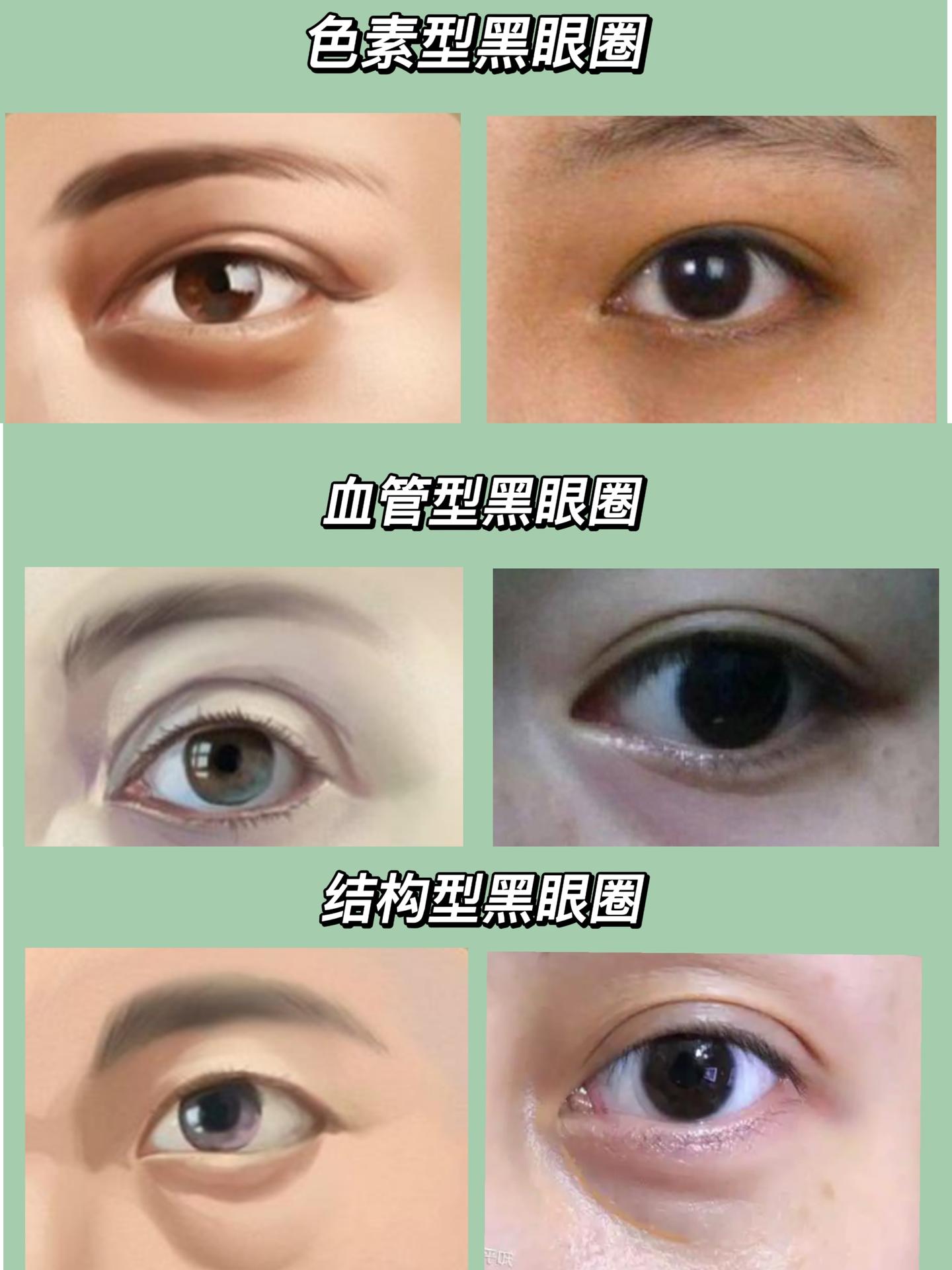 咋样才能让眼睛清澈 v2-9cd195fff854216ae80d65ec21a71dfd_1440w.jpg?source=172ae18b