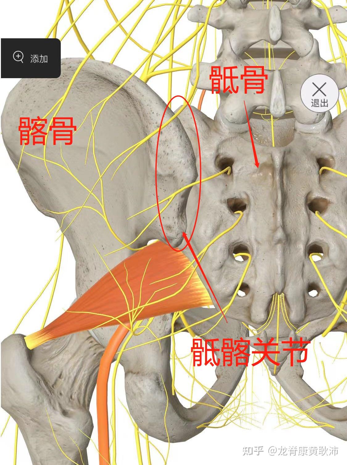 梨状肌松解图片