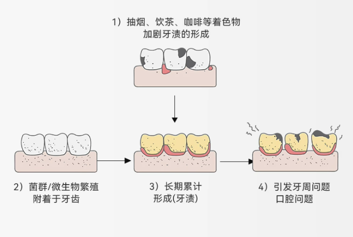 【牙医锐评】你的大黄牙都能替我上夜班了！别再瞎折腾了！专业去牙黄就4步！！！ - 知乎