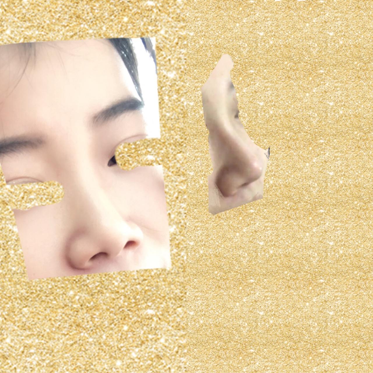 关于垫鼻梁的纪录和分享5