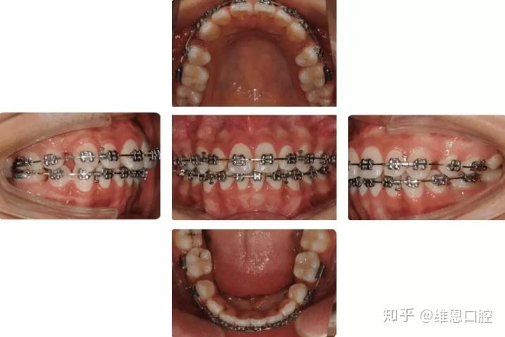 v2-9db2ce0bcd0f7701de9d1b3daab04b15_r.jpg