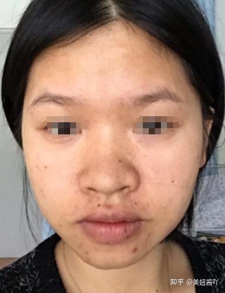 鼻子塌就一定很丑吗?