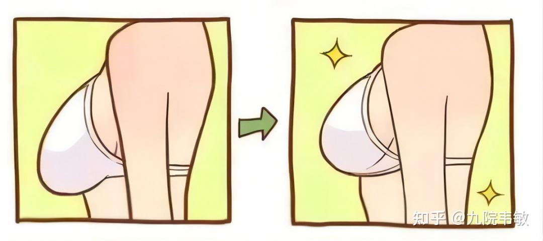 九院韦敏技术怎么样胸部下垂可不可以进行隆胸