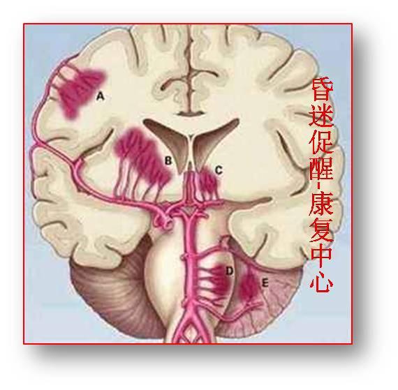 v2-9de7026b622dc1a2122086879e8bd5d7_1200x500.jpg