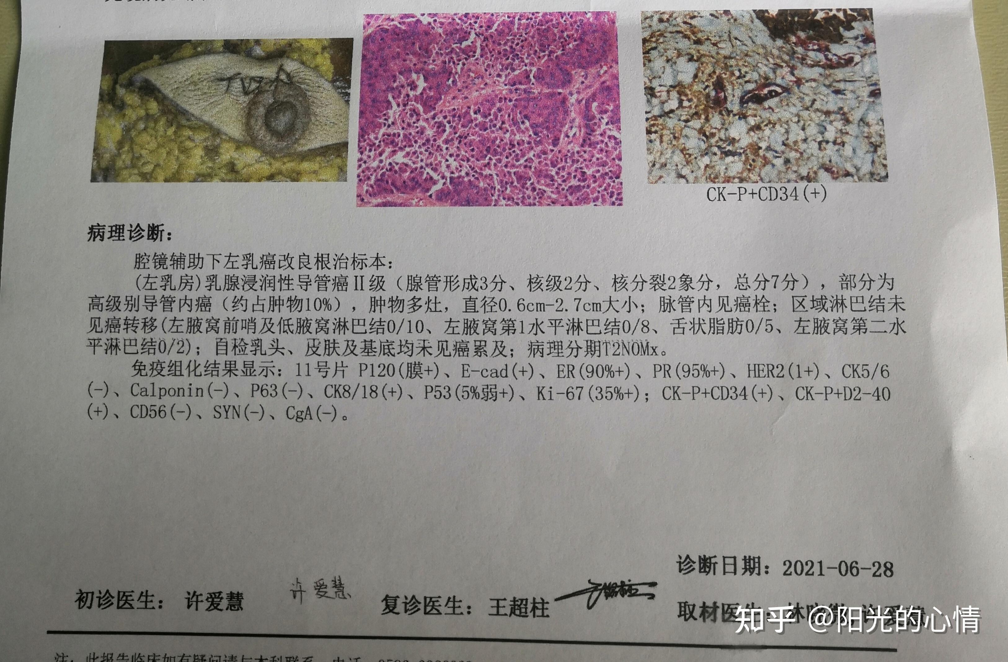 我是左乳腺浸润性导管癌,请能够看懂病理检查报告和疾病诊断书的