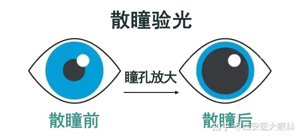 孩子散瞳验光几岁能做？什么情况下必须要散瞳？ - 知乎