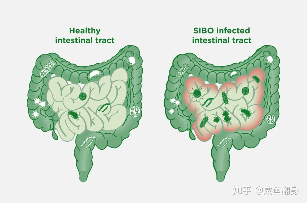 肠道菌群紊乱是百病之源,如何拯救肠道菌群失调?