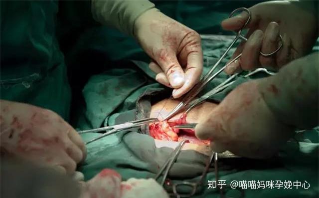 手术用的缝针是弯头的,这样便于操作.