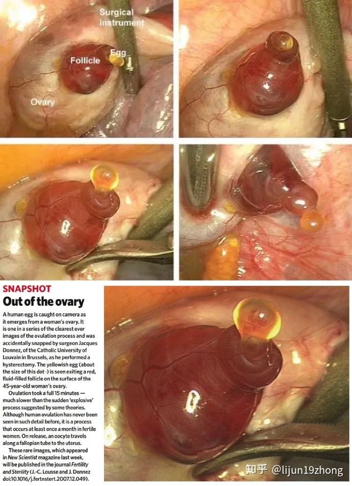 卵巢老化让女性终止排卵而不是卵子只有400颗