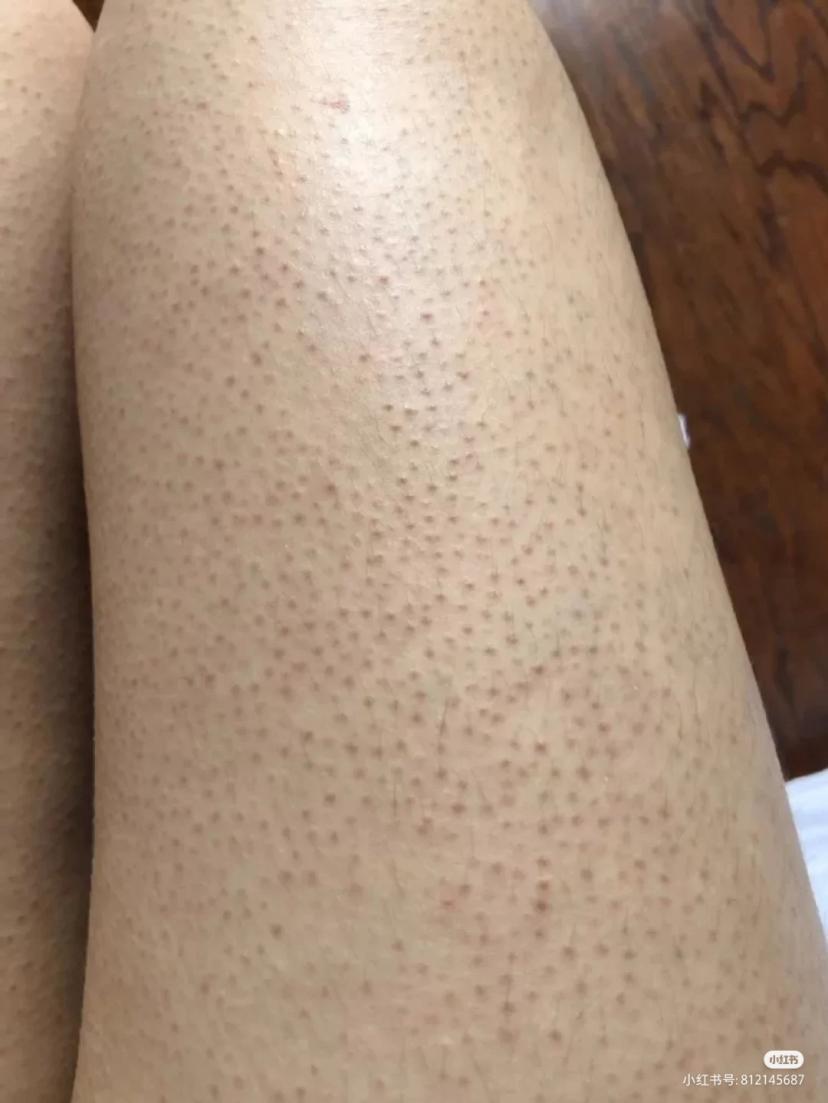 有用过多芬磨砂膏的吗?磨砂膏真的可以去鸡皮吗?