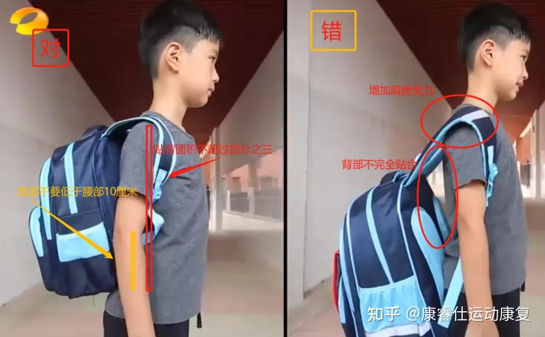 书包太重会引起孩子脊柱侧弯