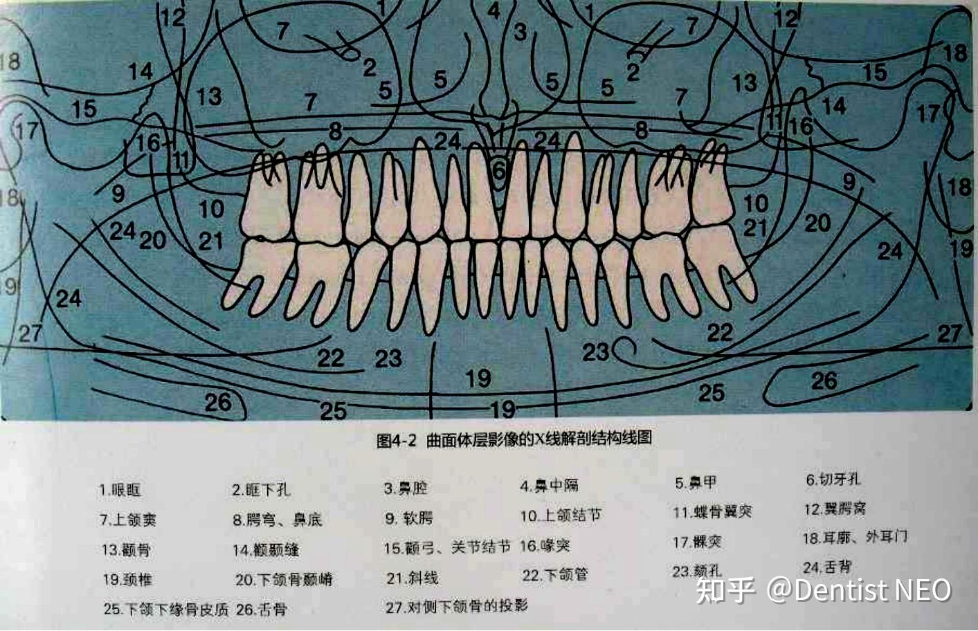 牙医教你看懂曲面断层全景片_哔哩哔哩_bilibili