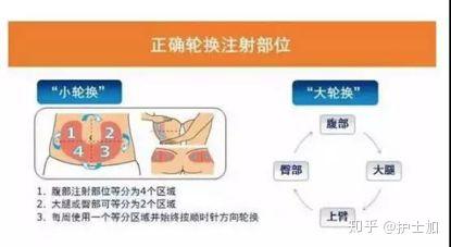 皮下注射就是打 三角肌 吗 解答皮下注射的10个临床问答 知乎