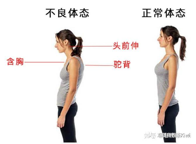 浅谈上交叉综合征