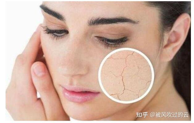 你还在为如何区分油皮,干皮和中性皮肤而发愁吗? - 知乎