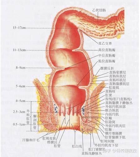 s状结肠图片