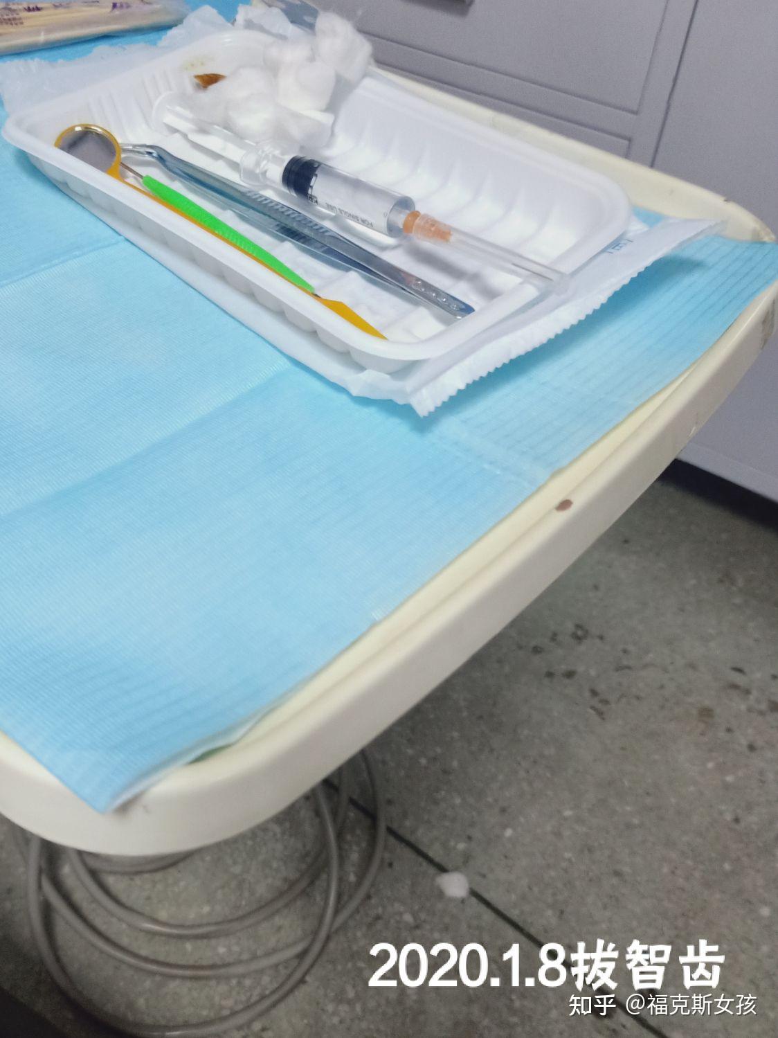 矫正牙齿过程 - 知乎